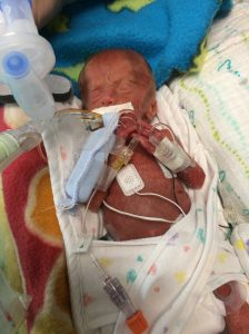 Life After The NICU: Preemie Families Share How Their Kids Are Doing Now