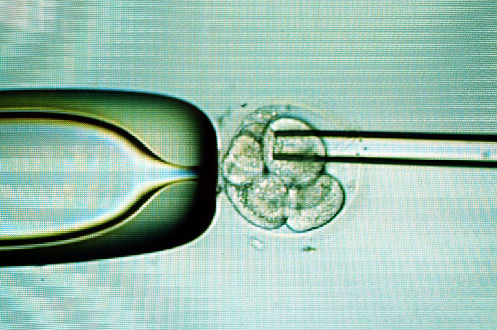 Should You Consider Preimplantation Genetic Testing?