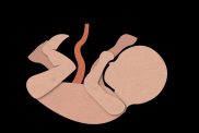 Illustration of baby with their umbilical cord attached.