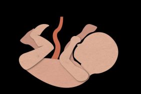 Illustration of baby with their umbilical cord attached.