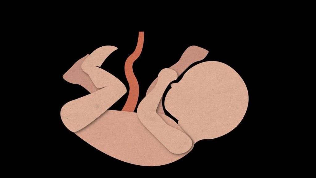 Illustration of baby with their umbilical cord attached.